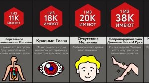 Самые Редкие Особенности Тела