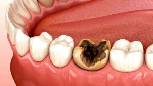 Лекция для детей по уходу за зубами с раннего возраста