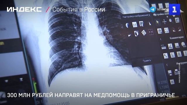 300 млн рублей направят на медпомощь в приграничье