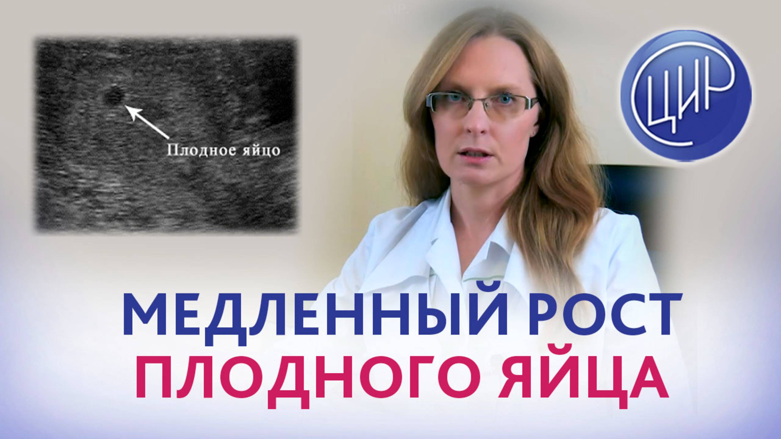 Медленный рост плодного яйца - угроза замершей беременности? Дрожжина А.И.