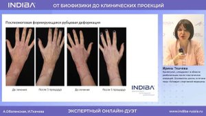 INDIBA - дуэт Ирины Ткачевой и Аллы Оболенской - дек. 2023