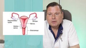 Как происходит удаление матки. Рутинная операция, кот?