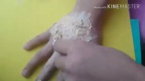 Воткнули себе в руку нож 🔪 😞