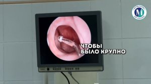 Катетеризация слуховой трубы.