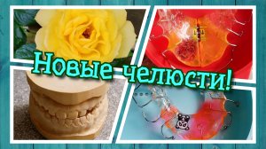 VLOG из 🇩🇪: Детям выдали новые брекеты.