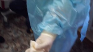 Клапанная бронхоблокация // Что это такое? И при чем тут туберкулез?