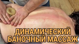 Динамический баночный массаж