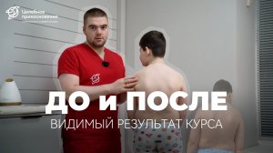 ДО и ПОСЛЕ: Результат после курса процедур | Целебное Прикосновение
