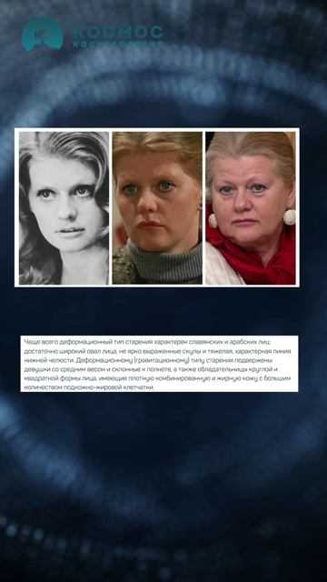 Самый благодарный тип старения!