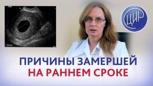 Причины замершей беременности на ранних сроках. Акушер-гинеколог ЦИР А.И. Дрожжина.