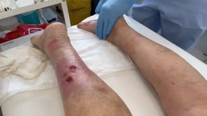 УХОД ЗА КОЖЕЙ НОГ - важен всегда. А наиболее важен при л