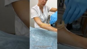 Депиляция рук
