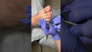 Мужской педикюр и его особенности