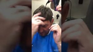 Установка мужской системы волос