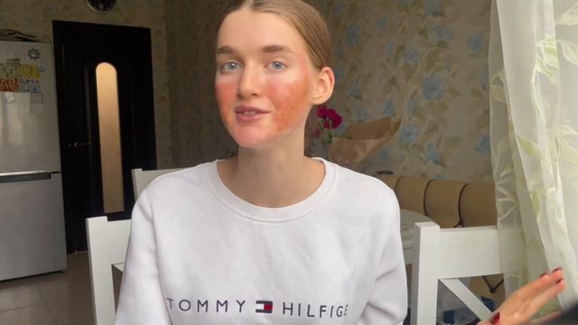 |ЛАЗЕРНАЯ ШЛИФОВКА| наглядный результат до/после (мой ? смотреть онлайн