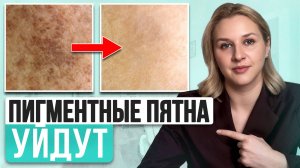 Самые ЛУЧШИЕ средства от пигментных пятен на лице! Как быстро вылечить гиперпигментацию?