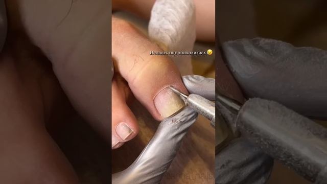 Если что маме уже пальчик вылечили 🥹 #педикюр #маникю? смотреть онлайн