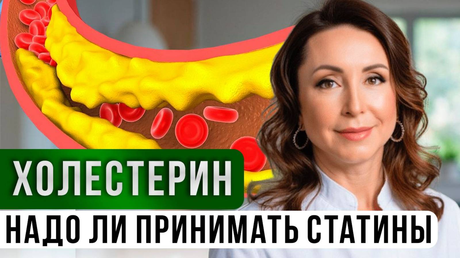КАК снизить ХОЛЕСТЕРИН БЕЗ ТАБЛЕТОК? Избавляемся от атеросклероза!