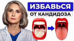 ЭТО поможет вам БЫСТРО и ЛЕГКО справиться с КАНДИДОЗОМ и другими грибковыми инфекциями