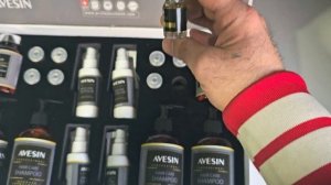 Результат пересадки волос через 40 дней