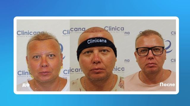 Еще один счастливый пациент в Clinicana