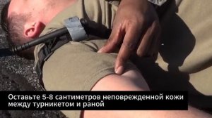 5. Наложение турникета