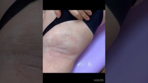 Депиляция сахарной пастой #депиляция #youtubeshorts #нижнийн