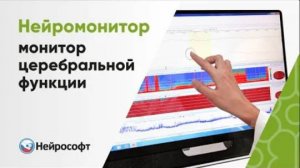 Нейромонитор – монитор церебральной функции с touchscreen-дисплеем на мобильной тележке