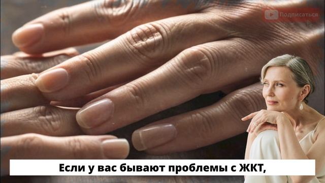 Что Значат Полоски на Ногтях Внимание Это Может Быть С смотреть онлайн