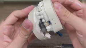 Подготовка каркаса анатомической коронки из диоксида циркония к нанесению