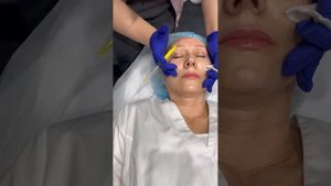 Как колоть Mayster PLLA Booster полимолочная кислота введение