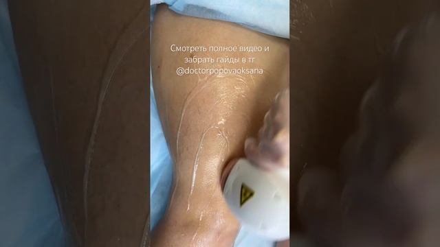 Мастеру лазерной эпиляции #удалениеволоснавсегда #вр?