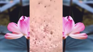 Новое выдавливание ПРЫЩЕЙ и ЧЕРНЫХ ТОЧЕК! p22