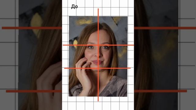 Причины ассиметрии лица. Фейспластика. Остеокоррекци? смотреть онлайн