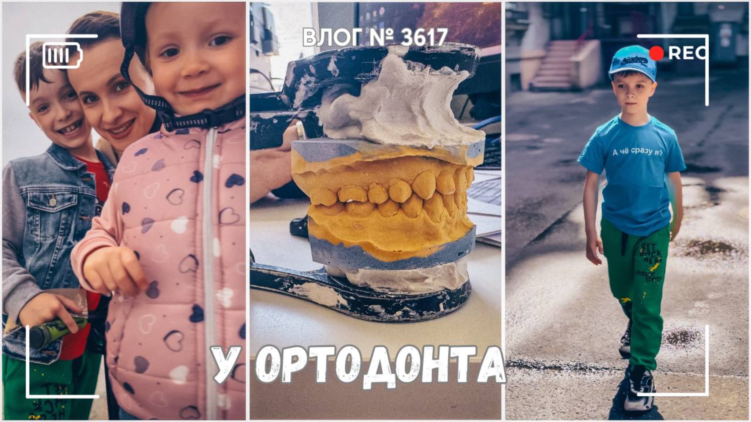 Два ортодонта  за день| Начинаем эксперимент | Отметили завершение  -  ВЛОГ №3617 - 31.05.25