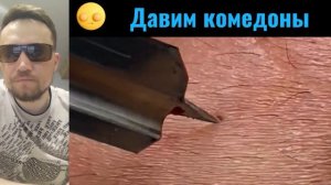 СМАЧНЫЕ черные точки №34