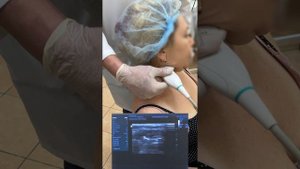 Цервикальная дистония (Спастическая кривошея).Ч.3.Груд