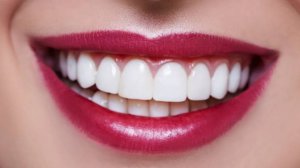 Отбеливание зубов дома