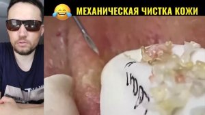 МОЩНЫЙ ЧИРЕЙ №25