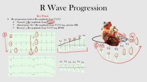 31.R Wave Progression