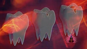 Кариес: чистые матрицы Гаряева Архив 2025 обновлённый уникальный по ссылке в описании