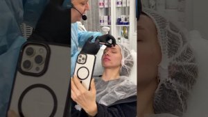 Коррекция ботулотоксином межбровной морщины. Обучени