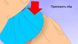 Травматизм
