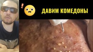 РЕДКИЙ СЛУЧАЙ у косметолога №24