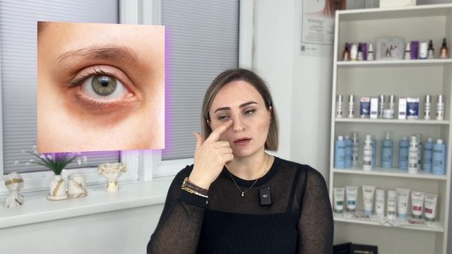 УХОД за кожей ВОКРУГ ГЛАЗ | Что делать ДОМА и у КОСМЕТО? смотреть онлайн