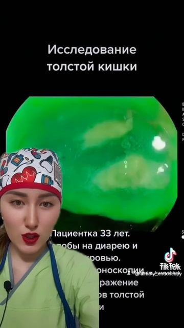 Болезнь Крона,как выглядит #shortsvideo #shortvideo #болезнькрон?