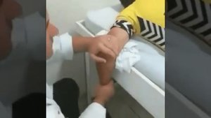 вывих локтевой суставов.