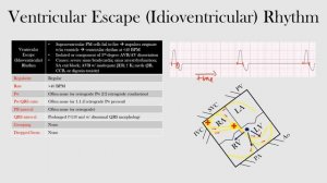 55.Ventricular Escape (Idioventricular) Rhythm