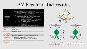 52.AV Reentrant Tachycardia