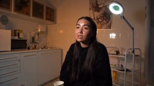 ИНСУЛЬТ восстановление| Исправляем асимметрию лица | Нитевой лифтинг ДО/ПОСЛЕ #инсультвосстановлени